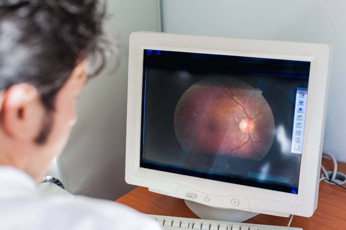 Retina Services