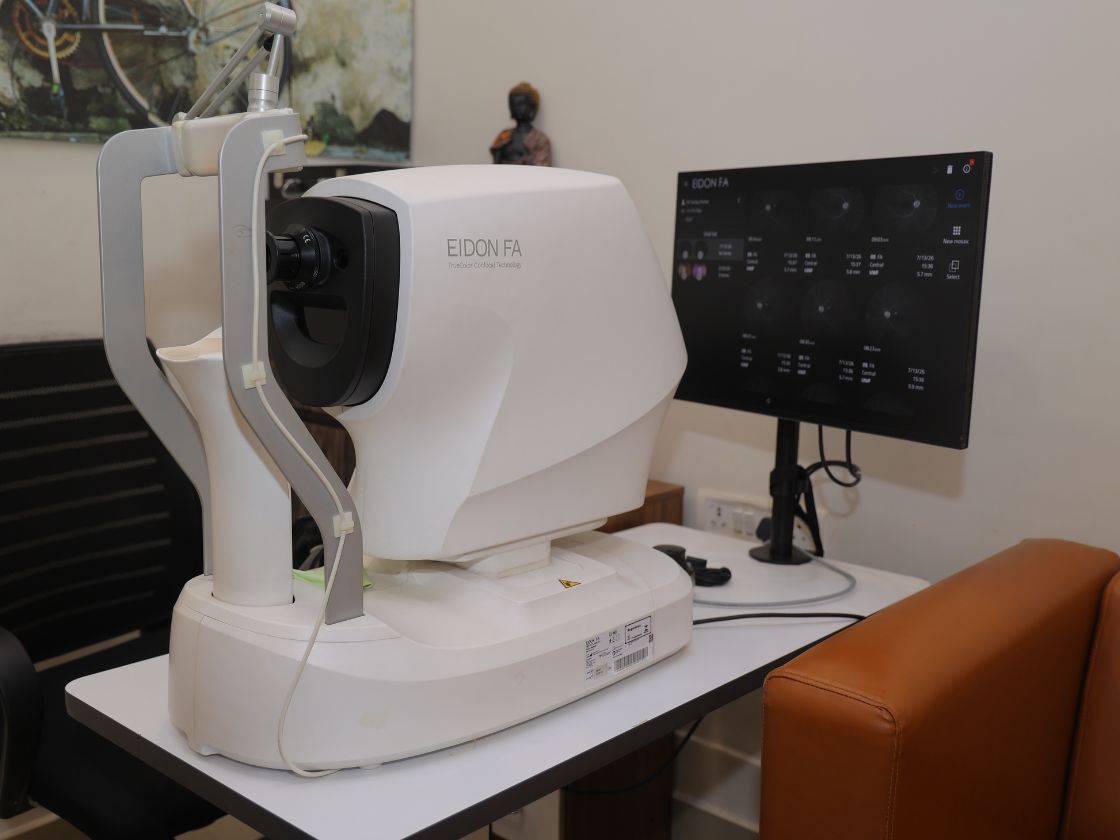 iCare EIDON FA Fundus Imaging